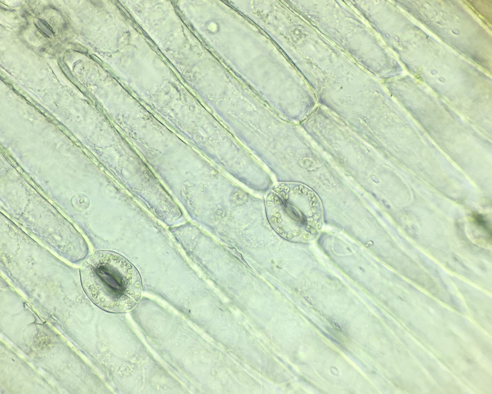 Patti par randhra (stomata) aur dwar koshikaen — photosynthesis notes class 10 in hindi